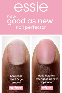 new essie ‘good as new’ nail perfector has a sheer pink demi-matte finish that instantly conceals any discoloration so your nails will look ‘good as new’���💅🏽✨ say goodbye to nail imperfections and hello to a flawless canvas for nail polish. shop now Neon Glow Nails, Wedding Guest Nails, Beachy Nail Designs, Early Fall Nails, Nail Vibes, Birthday Nail Designs, Mint Green Nails, Pastel Nail Art, Neon Nail Art