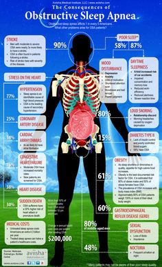 Consequences of obstructive sleep apnea Loss Of Motivation, Snoring Remedies, Respiratory Therapy, Loose Skin, How To Get Sleep, The Human Body