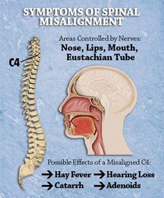 C4 C Spine Anatomy, Post Gallbladder Surgery Diet, Chiropractic Spine Chart, Gallbladder Surgery Diet, Spinal Decompression Therapy Chiropractic, Spine Health Chiropractic, Self Chiropractic Adjustment