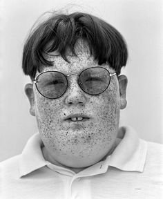 a black and white photo of a man with freckles on his face wearing glasses