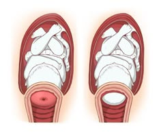 an image of a person's feet with the blood vessels exposed