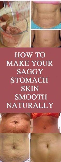 Tighten Stomach, Skin Firming Lotion, Skin Tightening Stomach, Tighten Loose Skin, Skin Bumps, Extra Skin, Saggy Skin, Loose Skin, Burn Belly Fat