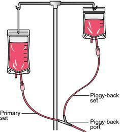 an image of a blood bag attached to a medical device with labels on the side