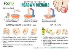 The latest in organic living with tips and info on food, gardening, natural remedies, and keeping your home free of harmful toxins. Ingrown Toenail Remedies, Nail Remedies, Coffee Facial, Top 10 Home Remedies, Toenail Fungus Remedies, Ingrown Toenail, Homemade Lotion, Luscious Hair, Home Remedies For Hair