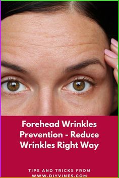 Forehead Wrinkles Prevention Reduce Wrinkles Right Way Wrinkles On Forehead, Reduce Forehead Wrinkles, Rid Wrinkles, Wrinkle Remedies, Wrinkle Free Skin, Erase Wrinkles, Diy Acne, Forehead Wrinkles, Skin Spots