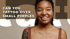 Can You Tattoo Over A Small Pimple. There are any references about Can You Tattoo Over A Small Pimple in here. you can look below. I hope this article about Can You Tattoo Over A Small Pimple can be useful for you. Please remember that this article is for reference purposes only. #can #you #tattoo #over #a #small #pimple Ruin Tattoos, Small Pimples, Trending Tattoo, Man Tattoo, Acne Scarring, Chest Tattoos, Skin Tags, Ingrown Hairs