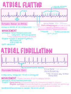 an info sheet with the words atrialal fibrilation written in pink and blue