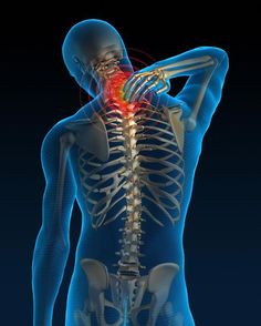 Neck Pain – Cervical Spondylosis and other degenerative disc diseases – Treatment - Mobilization Exercises Stiff Neck Remedies, Cervical Spondylosis, Stiff Neck, Spine Surgery, Power Trip, Sciatic Nerve Pain, Neck Pain Relief, Strengthening Exercises