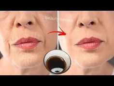 Rejuvenique Oil Before And After, When To Use Face Oil, Best Face Oil Anti Aging, How To Use Olive Oil For Face, Olive Oil In Coffee, Olive Oil For Face Skincare, Olive Oil Uses, Wrinkles Remedies Face, Natural Skin Care Remedies