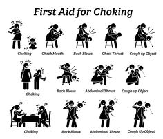 First aid emergency treatment for choking stick figures icon. Vector illustrations of baby, child, and adult choking while getting rescued with Heimlich Maneuver method. assist; toy; eating; adult; teen; teenager; baby; infant; toddler; small; kid; child; heimlich maneuver; abdominal; cough up; object; thrust; chest; blow; back; mouth; check; choking; positions; person; guide; choke; medical; how to; step by step; procedures; help; ways; methods; response; techniques; treat; treatment; emergency Heimlich Maneuver, Safety Poster, Miniature People, Trening Sztuk Walki, Social Life Hacks, Survival Skills Life Hacks, Body Map