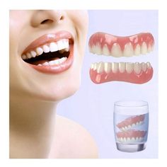 Prótese Instantânea Smile Veneers  - Superior E Inferior Perfect Teeth Smile, Bottom Teeth, Veneers Teeth, Bad Teeth, False Teeth