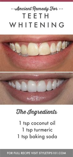 Teknik Makeup, Teeth Whitening Homemade, Teeth Whitening Remedies, Teeth Whitening Diy, Tooth Enamel, The Teeth, Natural Teeth Whitening, Natural Teeth, White Teeth