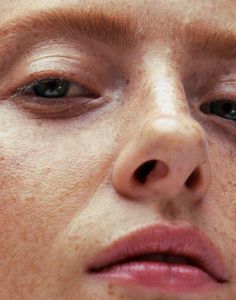 a woman with freckles on her face looking at the camera