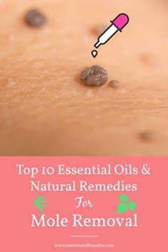 Whether you want to remove a flat or raised mole, find out the best essential oils and natural remedies to remove it naturally at home with no pain or scarring. Essential Oil Wart Remover Recipe, Skin Tags Essential Oils, Remove Moles, Skin Care Routine For 20s, Mole Removal, Skin Tags, Natural Healing Remedies, Essential Oil Benefits