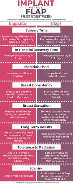 Mastectomy Reconstruction, Breast Implant Illness, Breast Reconstruction, Health And Fitness Magazine, Healthy Diet Tips, Surgery Center, Good Health Tips, Health And Fitness Tips