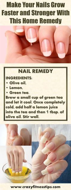 Add these actionable, helpful steps to your nail care routine, and you'll have stronger, longer nails before you know it. Nails Grow Faster, Nail Remedies, Longer Nails, Grow Nails Faster, Broken Nails, Nail Care Tips, Nail Care Routine, How To Grow Nails, Essential Oils For Hair