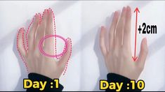 two hands are shown with one hand holding the other's thumb and pointing at it