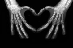 two hands in the shape of a heart are shown with their arms extended to each other