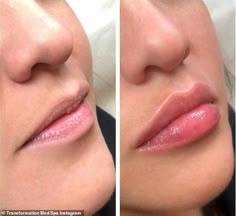 Lips Illustration, Lip Plumping Balm, Permanente Make-up, Lips Inspiration, Korean Lips, Peach Lips, Lip Scrub Diy, Facial Fillers, Lip Balm Collection