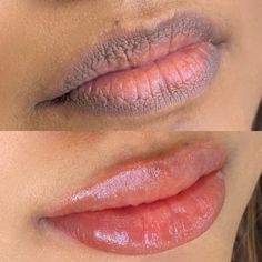 Dark lip correction with lip blush tattoo Lip Pigmentation Tattoo, Lip Tint Tattoo, Cosmetic Lip Tattoo, Lip Blush Tattoo, Bb Lips, Blush Tattoo, Lip Blushing, Lip Lightening, Dark Lip