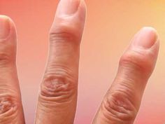 a person's hand with an ectomid on the middle finger and fingers