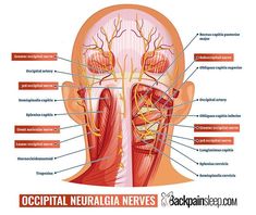 Best Exercises for Occipital Neuralgia: 3 Stretches for Pain Relief Jaw Pain Relief, Occipital Neuralgia, Text Neck, Headache Types, Jaw Pain, Ways To Sleep, Cervical Pillows, Neck And Shoulder Pain