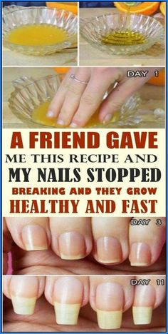 Fast Day, Health Signs, Tongue Health, Strong Nails, Nail Health, Natural Beauty Tips, Lose 50 Pounds, Healthy Nails, My Nails