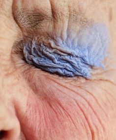 an older woman's eye with wrinkles and blue thread on the iris area