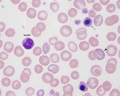 Nucleated RBC versus lymphocytes | eClinpath Lithium Toxicity Nursing, Electrical And Chemical Synapses, T Lymphocyte, Polytene Chromosome, Systemic Mastocytosis, White Blood Cells, Veterinary Technician, Funny Clips