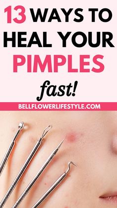 HOW TO GET RID OF ACNE, PIMPLES, BUMPS ON FACE OVERNIGHT | Simple Home Remedy (DIY Lemon Treatment) Neck Pimples, Get Rid Of Pimples Overnight, Rid Of Pimples Overnight, Painful Pimple, Big Pimple, Get Rid Of Pimples, Blind Pimple, Rid Of Pimples, Pimples Under The Skin