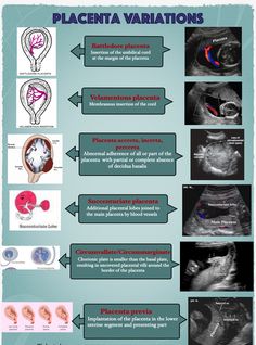 Ultrasound Notes Study, Sonography Notes Ultrasound, Ultrasound Technician Aesthetic Notes, Diagnostic Medical Sonography Student Notes, Ultrasound Technician Notes, Sonography Student Notes, Sonography Student Study Obgyn, Ultrasound Tech Study Notes, Black Ultrasound Technician