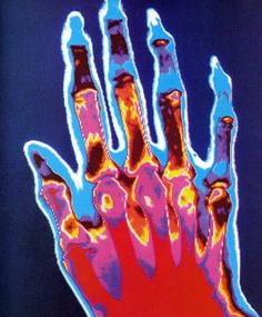 an image of a hand that has been altered to look like it is in color