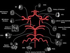 an image of a diagram with many different things in it, including the brain and peripherals