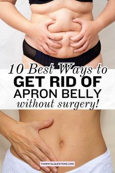 Discover effective ways to get rid of apron belly without surgery!  Explore our postpartum health tips and tricks for toning and tightening your midsection naturally. Say hello to a healthier, happier you with simple lifestyle changes and targeted exercises. Postpartum workouts, how to lose apron belly.