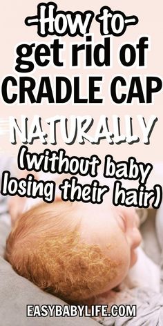 a baby laying down with the words how to get rid of cradle cap naturally without baby losing their hair