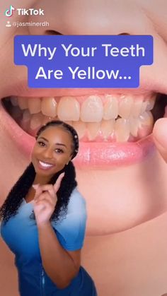 Get Rid Of Yellow Teeth, Dental Tips