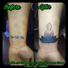 before and after photos of tattoo removals on both wrist, the same person is sitting in a lotus position