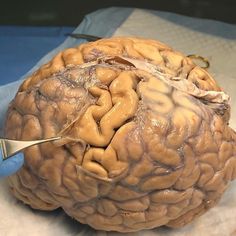 a person cutting through the side of a human brain with scissor and scissors