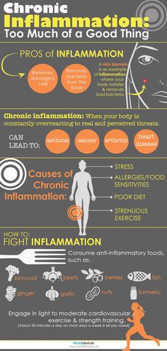 Body Inflammation, Anti Dieting, Anti Inflammation, Inflammatory Foods, Chronic Inflammation, Sciatica, Health Info, Health Remedies, Chronic Illness