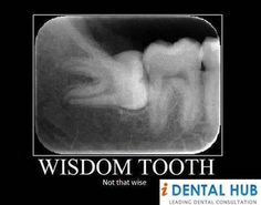 Frequently Asked Questions about Wisdom Teeth Wisdom Tooth, Dental Jokes, Dental Fun, Dentist Humor, Dental Humor, Pediatric Dentistry, Wisdom Teeth, Teeth Care, Sensitive Teeth