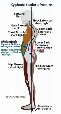 Posture Fix, Bolesti Chrbta, Forward Head Posture, Yoga Anatomy, Posture Exercises, Muscle Anatomy, Chest Muscles, Neck And Back Pain, Hip Flexor