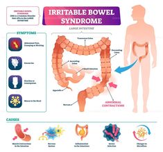 Human Body Digestive System, Mucus In Stool, Healthcare Illustration, Human Body System, Irritable Bowel Disease, Full License, Gastric Problem, Ibs Diet, Medical Facts