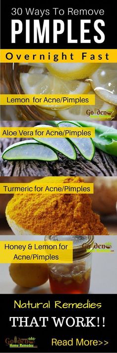 Homemade Acne Remedies, Doterra Acne, Removing Pimples, Remedies For Pimples, Get Rid Of Pimples Overnight, Rid Of Pimples Overnight, Chest Acne, Home Remedies For Pimples, Get Rid Of Pimples