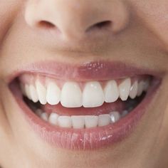 Get Whiter Teeth, Teeth Whitening Diy, Loose Tooth, Smile Teeth