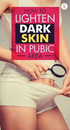 Do you have a dark bikini line? Do you wish to wear a bikini and look super hot and sexy, Skin Lightening Diy, Skin Rashes, Hair Help, Lighten Skin