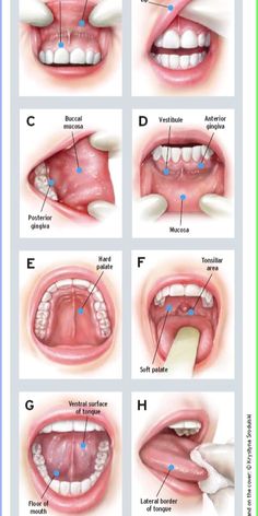 Oral and oropharyngeal cancers account for more than 58,000 new cancer cases each year in the U.S. alone, according to the Oral Cancer Foundation. Early detection is crucial for successful treatment, making routine dental check-ups more than about clean teeth and fresh breath.\n\nDentists can play a vital role in identifying oral cancer at its early stages, significantly improving the odds of their patients overcoming the condition. Read more... Dental Assistant Study Guide, Dental Assistant School, Dental Hygienist School, Dental Assistant Study, Dental Hygiene Student, Dental World, Dental Hygiene School, Dentistry Student, Dental Anatomy