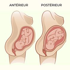 an image of the inside of a baby's stomach with text that reads occupt posterior effect on labor