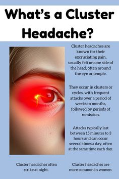 Ever experienced a sudden, excruciating headache that comes in clusters? You might be dealing with a cluster headache. Learn about the symptoms, causes, and treatment options for this debilitating condition. #clusterheadache #headache #migraine  #chronicillness  #invisibleillness Causes Of Migraine Headaches, Headache Chart, Cluster Headache, Headache Causes, Migraine Pain, Hashimotos Disease, Homeopathy Medicine, Medical Facts, Migraine Relief