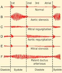 the different types of sound waves are shown in red and white, along with each other