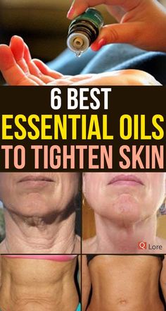 Tighten Loose Skin, Tighten Skin, Loose Skin, Best Essential Oils